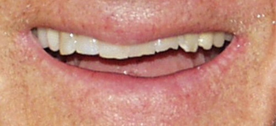 Before treatment
