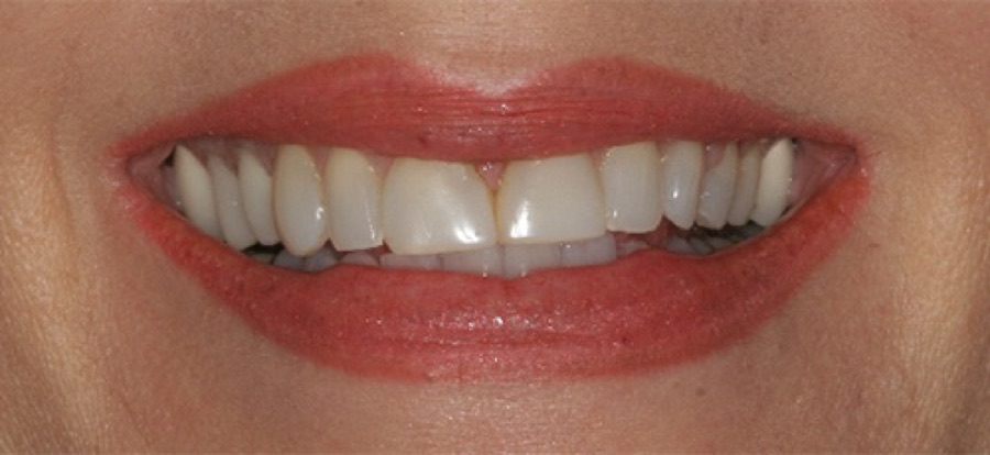 Before treatment