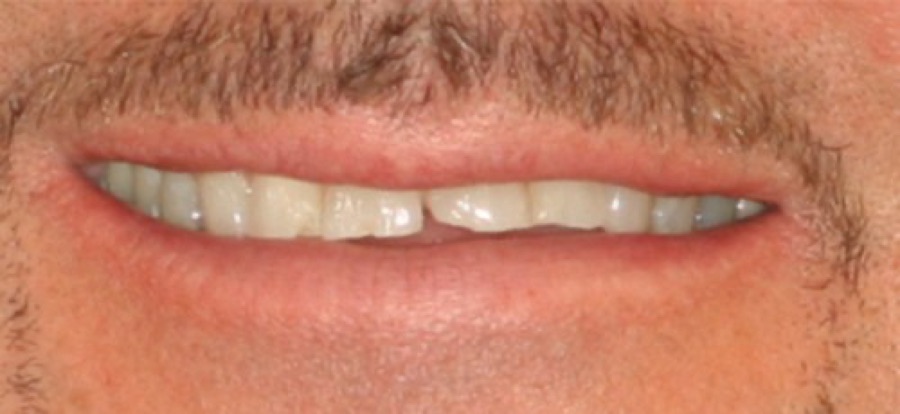 Before treatment