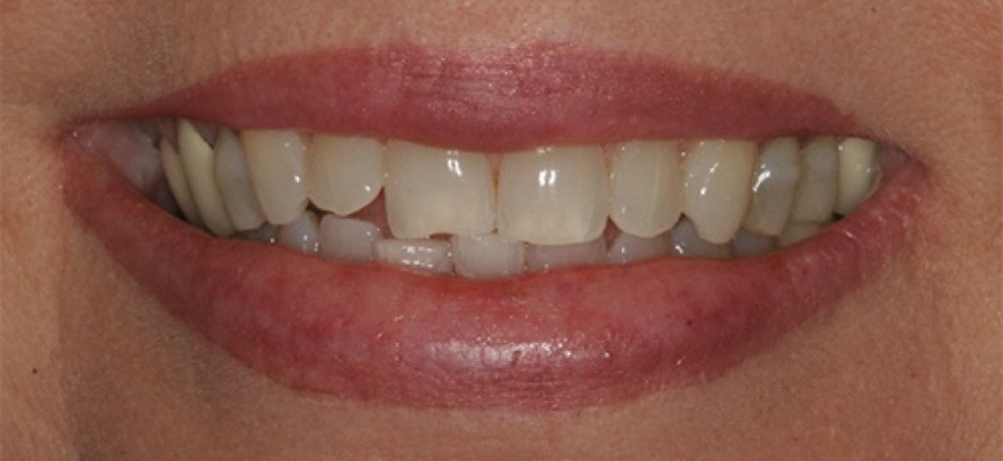 Before treatment