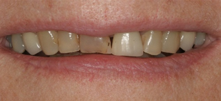 Before treatment
