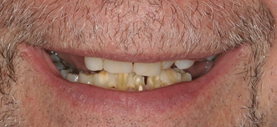 Before treatment