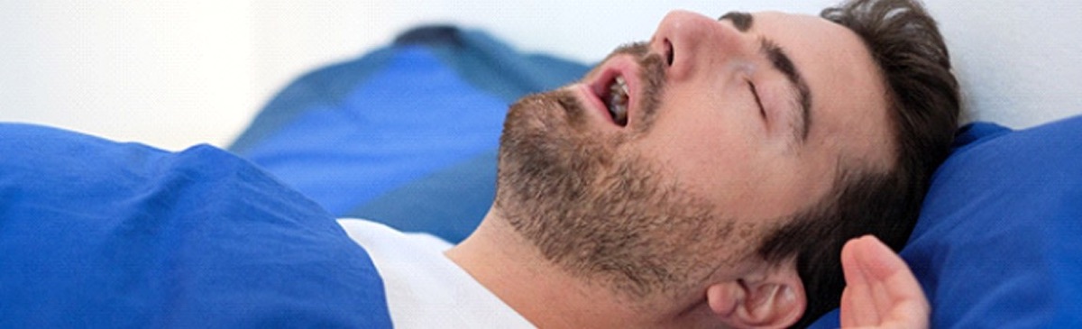 Sleep apnea therapy