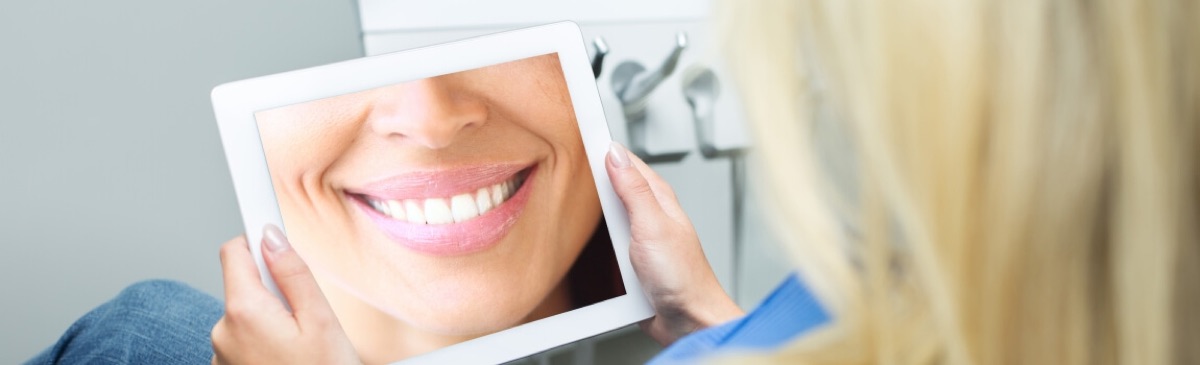 Digital smile design